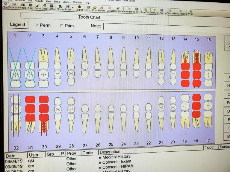 Dental xrays Prosperity Passenger